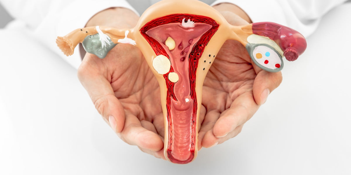 Hubungan Siklus Menstruasi Pada Kesehatan Reproduksi Wanita